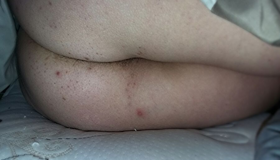 Free porn pics of My wife naked fat white ass, asscrack hair spilling out, thick m 5 of 44 pics