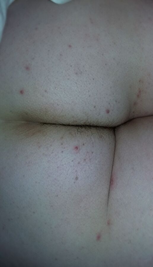 Free porn pics of My wife naked fat white ass, asscrack hair spilling out, thick m 19 of 44 pics