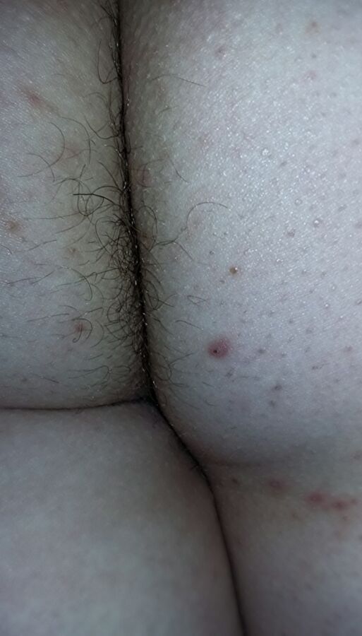 Free porn pics of My wife naked fat white ass, asscrack hair spilling out, thick m 17 of 44 pics