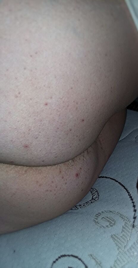 Free porn pics of My wife naked fat white ass, asscrack hair spilling out, thick m 1 of 44 pics
