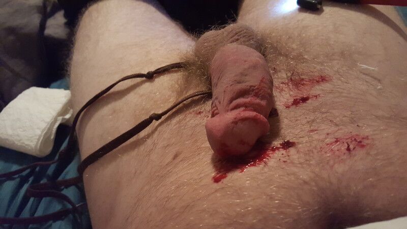 Free porn pics of Extreme cbt warning: graphic/blood 12 of 12 pics