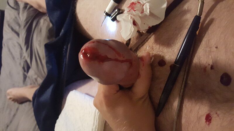 Free porn pics of Extreme cbt warning: graphic/blood 11 of 12 pics