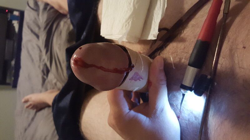 Free porn pics of Extreme cbt warning: graphic/blood 9 of 12 pics