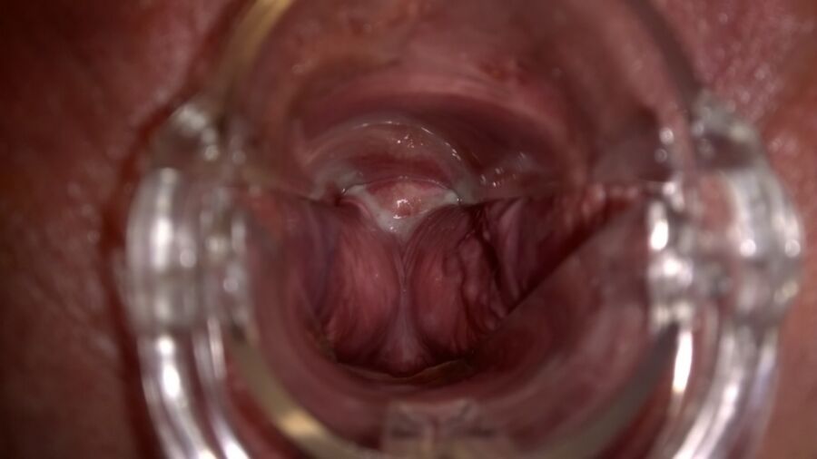 Free porn pics of Creamy Cervix 6 of 8 pics