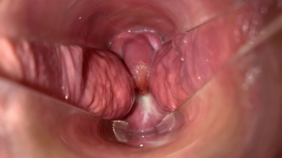 Free porn pics of Creamy Cervix 8 of 8 pics