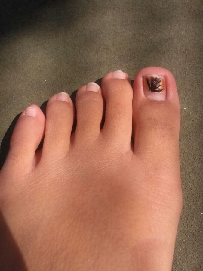 Free porn pics of D. Rose feet (Kik) 1 of 6 pics