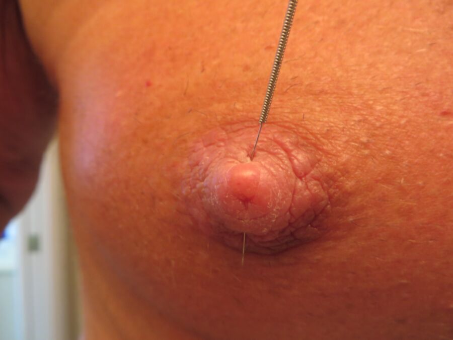 Milf needles tits nipples