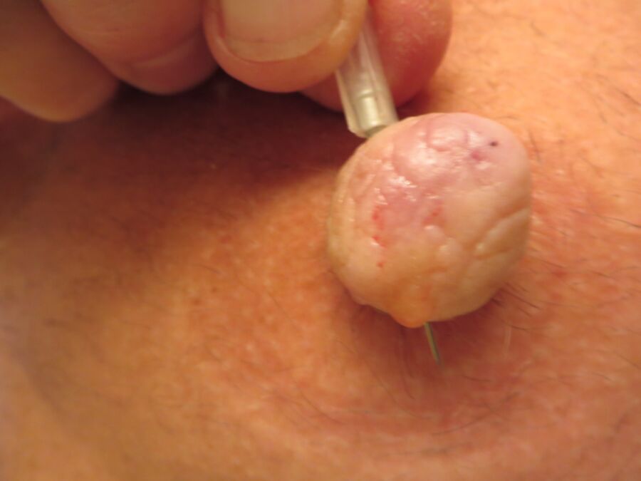 Free porn pics of The latest needle nipple pictures 8 of 10 pics