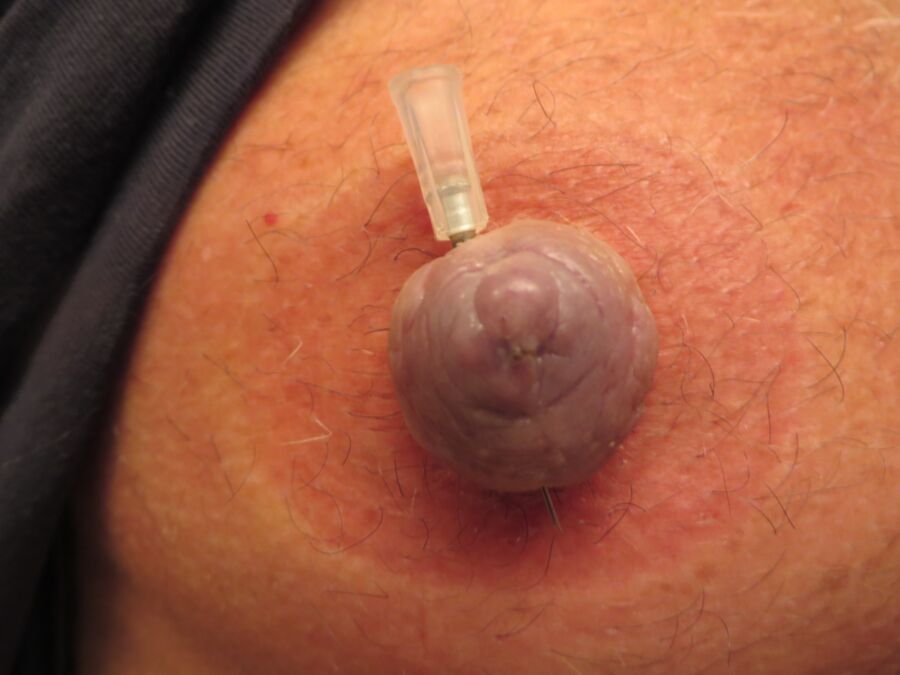 Free porn pics of The latest needle nipple pictures 1 of 10 pics