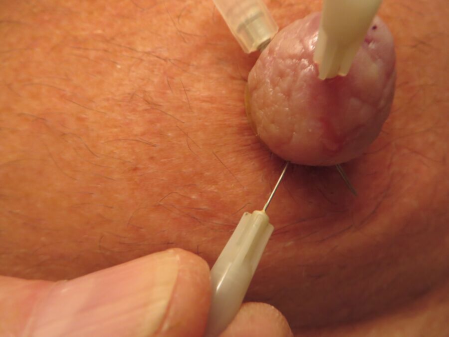 Free porn pics of The latest needle nipple pictures 7 of 10 pics