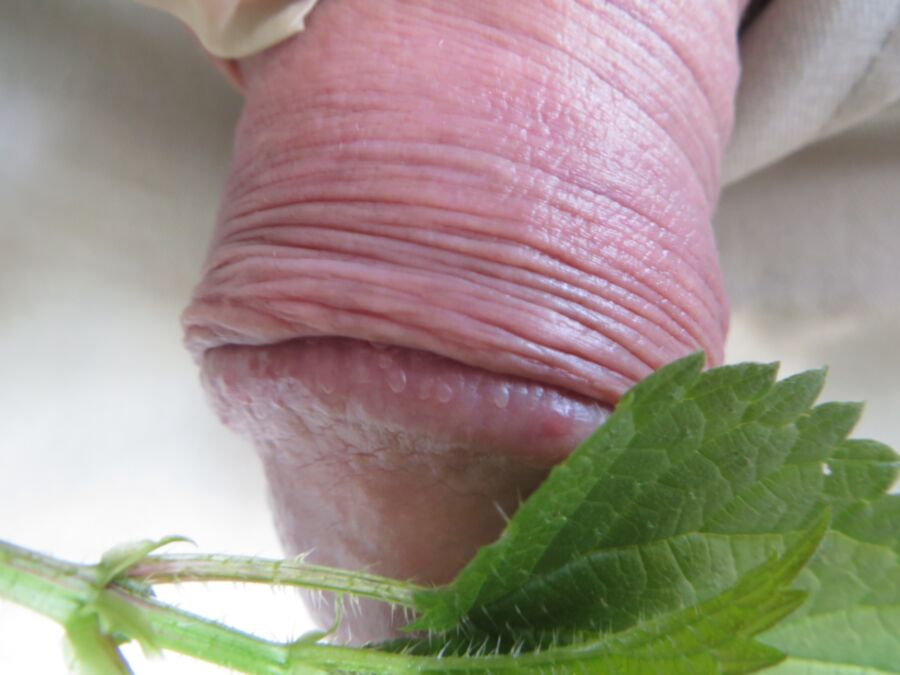 Free porn pics of swollen from the nettles 3 of 37 pics