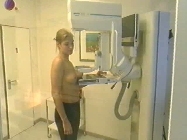 Free porn pics of Mammogram screencaps 8 of 40 pics