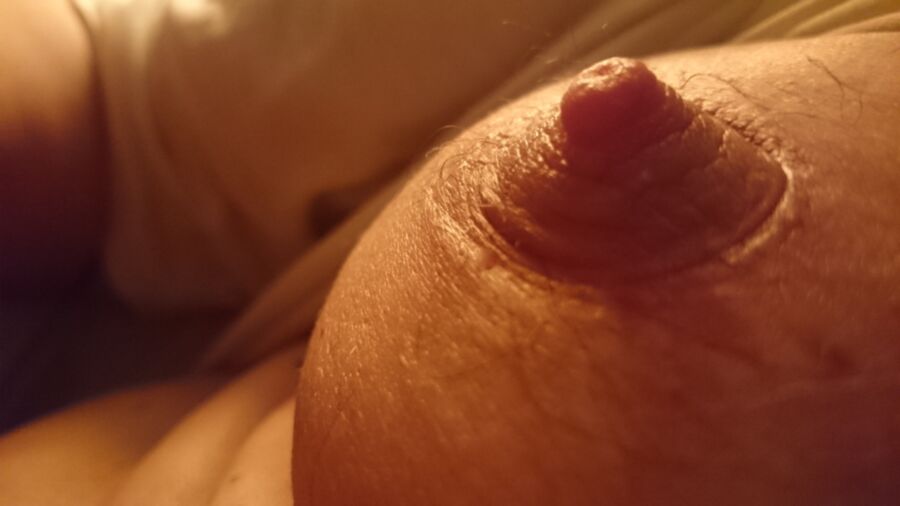 Free porn pics of My nipples after being strongly sucked into a pump. 14 of 14 pics