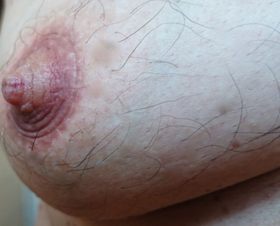 Free porn pics of My nipples after being strongly sucked into a pump. 1 of 14 pics