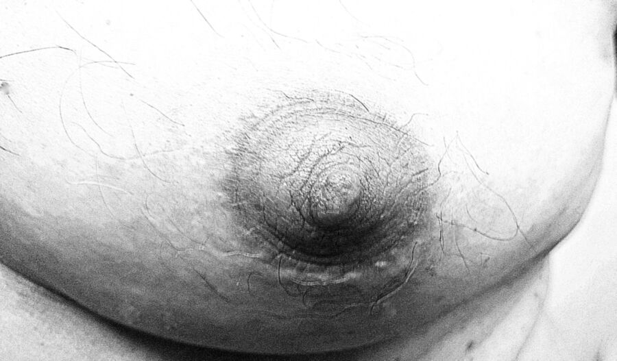 Free porn pics of My nipples after being strongly sucked into a pump. 4 of 14 pics