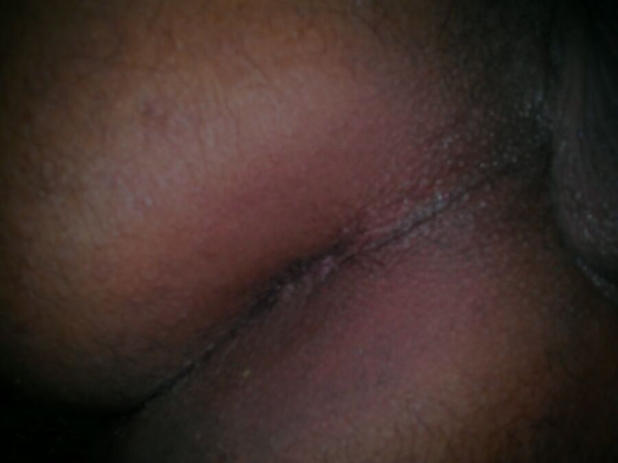Free porn pics of ass hole  3 of 5 pics