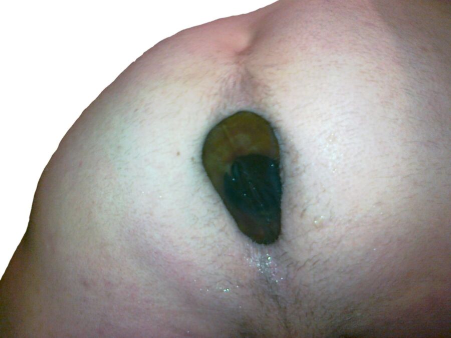 Free porn pics of Large Plugg (deep penetration) and Prolapse !!!! 4 of 24 pics