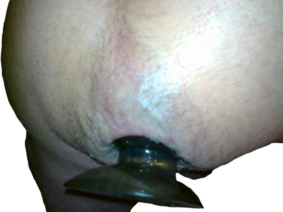 Free porn pics of Large Plugg (deep penetration) and Prolapse !!!! 16 of 24 pics