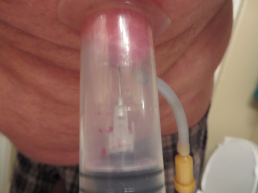 Free porn pics of needle vacuumed into nipple 10 of 16 pics