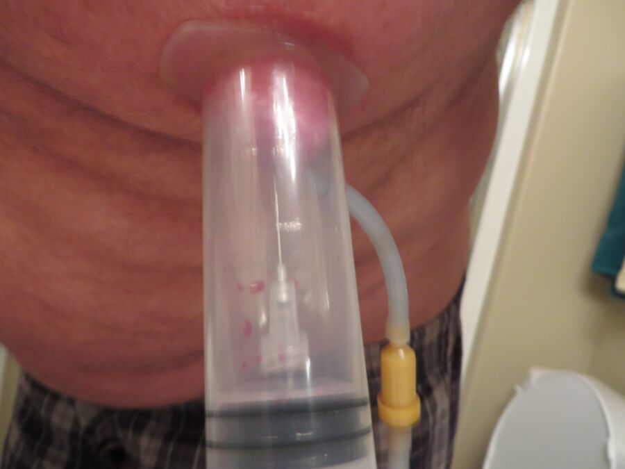 Free porn pics of needle vacuumed into nipple 8 of 16 pics