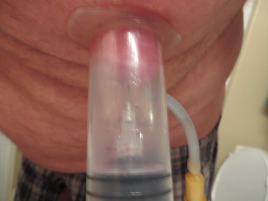 Free porn pics of needle vacuumed into nipple 11 of 16 pics