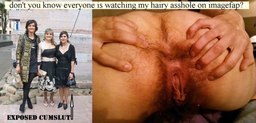 Free porn pics of exposed hairy cumslut gf 1 of 5 pics