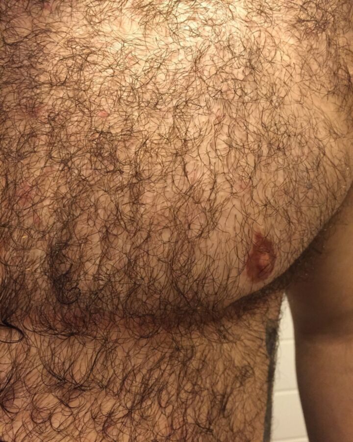 Free porn pics of Hairy chests from around the world  5 of 6 pics
