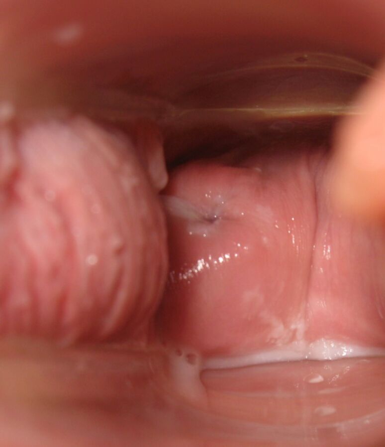 Free porn pics of Cervix Month 15 of 31 pics