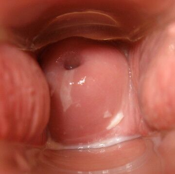 Free porn pics of Cervix Month 18 of 31 pics