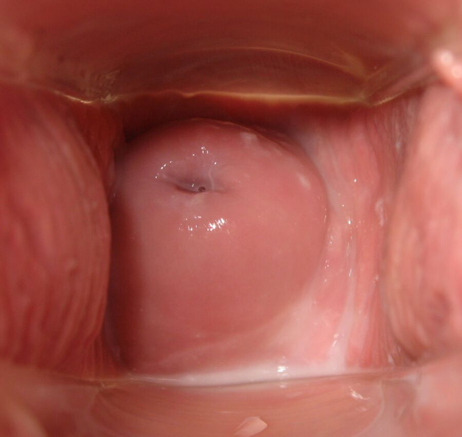 Free porn pics of Cervix Month 19 of 31 pics