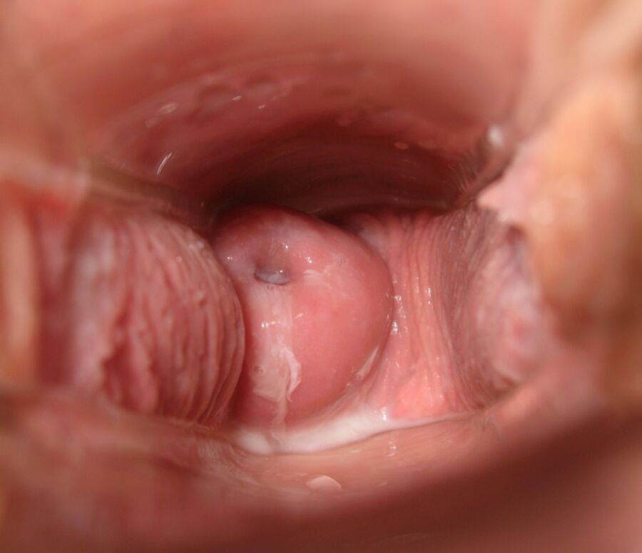 Free porn pics of Cervix Month 14 of 31 pics