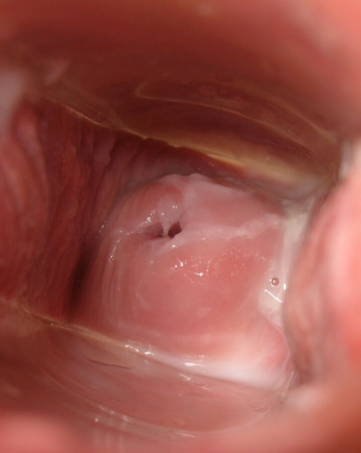 Free porn pics of Cervix Month 16 of 31 pics
