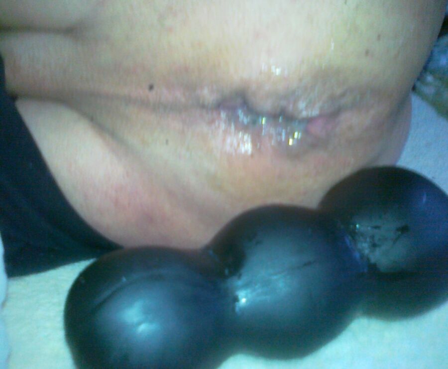 Free porn pics of Triple Balls Deep Penetrated My Ass( Prolapse !!!!) 18 of 31 pics