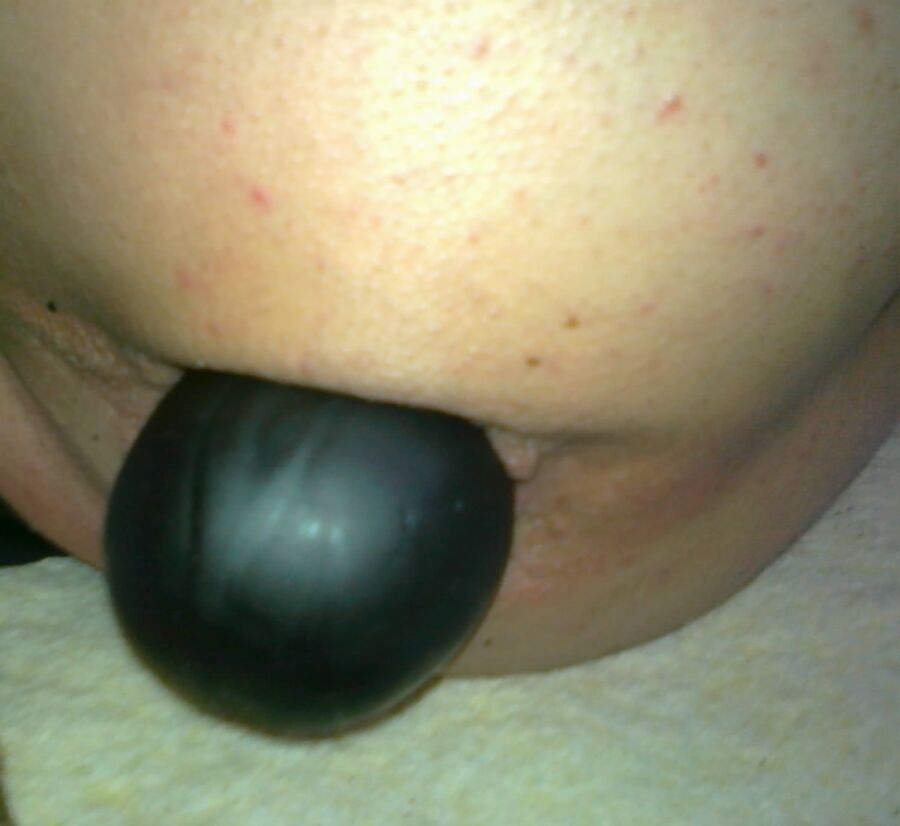 Free porn pics of Triple Balls Deep Penetrated My Ass( Prolapse !!!!) 11 of 31 pics