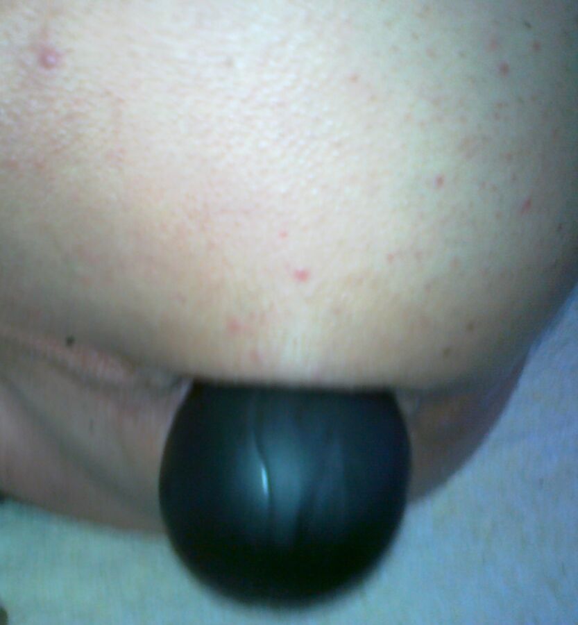 Free porn pics of Triple Balls Deep Penetrated My Ass( Prolapse !!!!) 1 of 31 pics