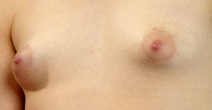 Free porn pics of Close Up Tits 23 of 45 pics