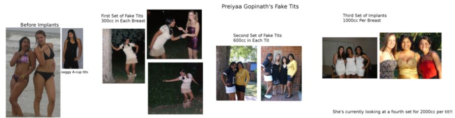 Free porn pics of Huge Fake Tits on Fat Indian Slut Preiyaa Gopinath 6 of 25 pics