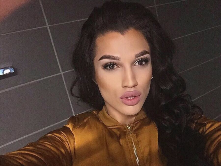 Free porn pics of Divinely Beautiful Fake Lips Latina Teen Bimbo  24 of 24 pics