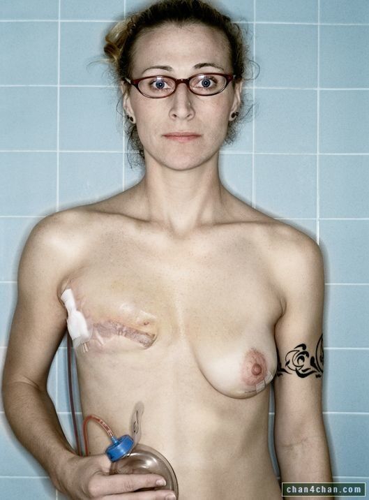 Free porn pics of Breastless Women 2 of 16 pics