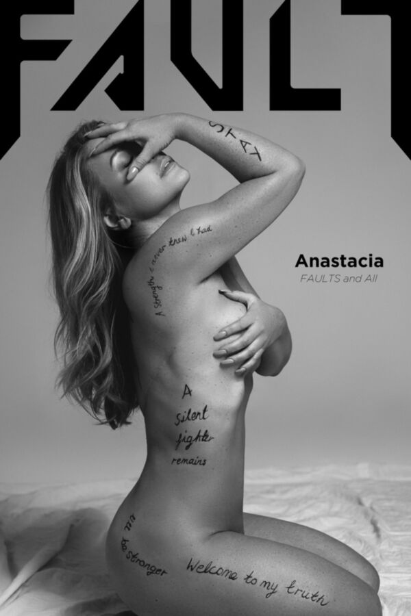 Free porn pics of Anastacia, FAULT MAGAZINE  Mastectomy Scars 1 of 5 pics