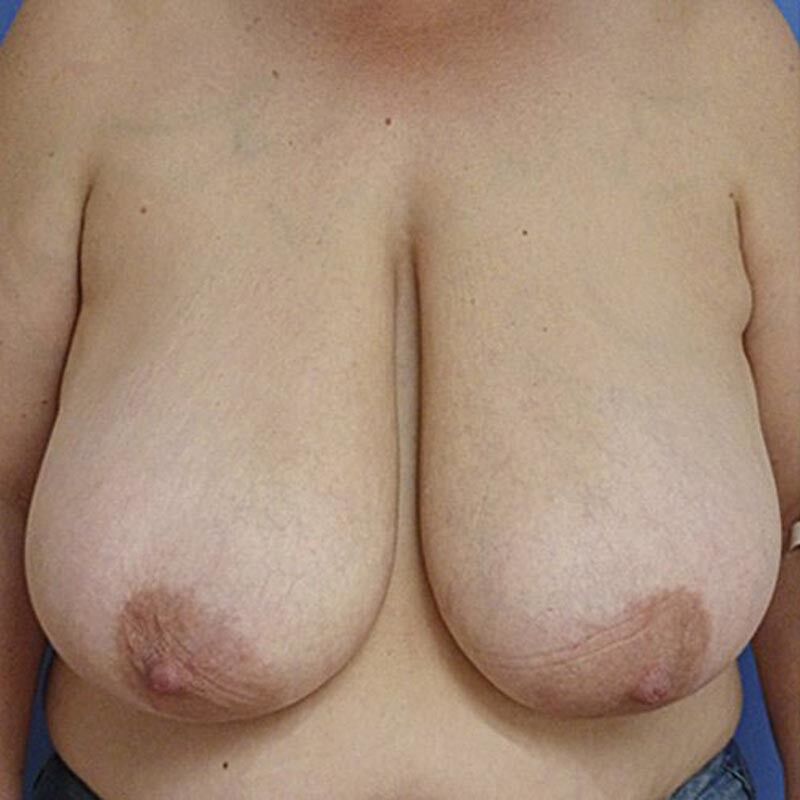 Free porn pics of big titts bbw 17 of 25 pics