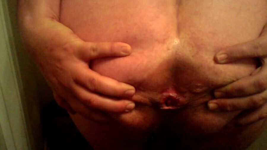 Loose asshole pics Mature shaved video galleries