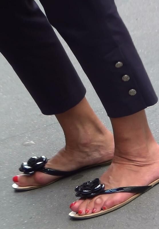 Free porn pics of Bunions 21 of 35 pics