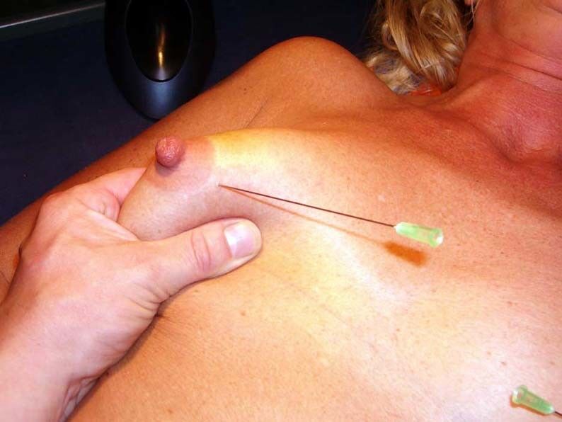Needle play saline injection tranny