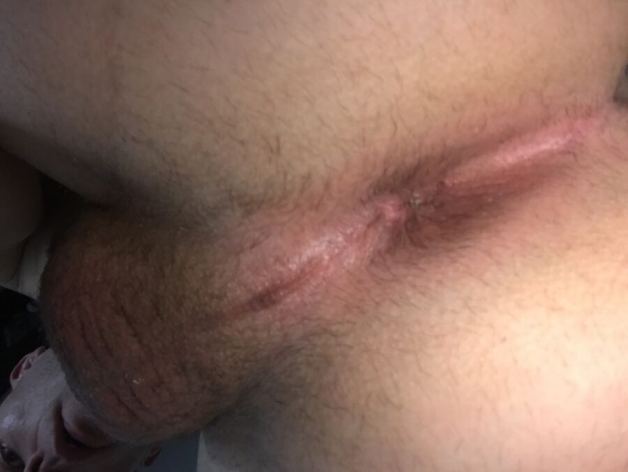 Free porn pics of Self torture with needles  3 of 4 pics