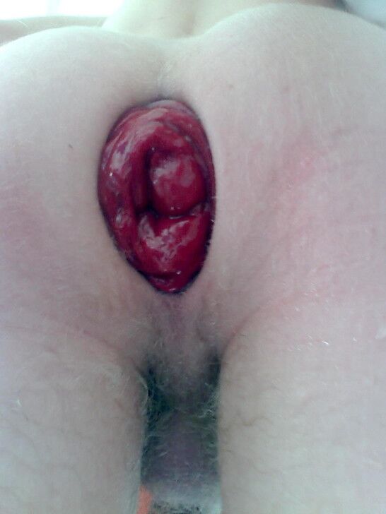 Free porn pics of my wrecked hole 3 of 11 pics
