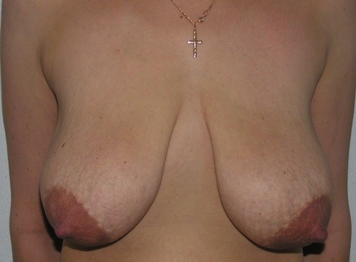 Free porn pics of Sagging Breasts  8 of 9 pics