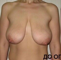 Free porn pics of Breasts Normal Cupsize 1 of 22 pics