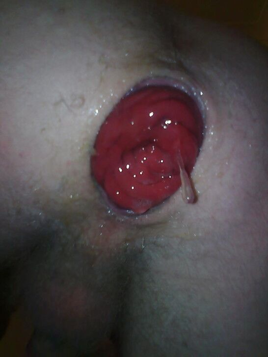 Free porn pics of my loose gaping wrecked asshole 2 of 9 pics