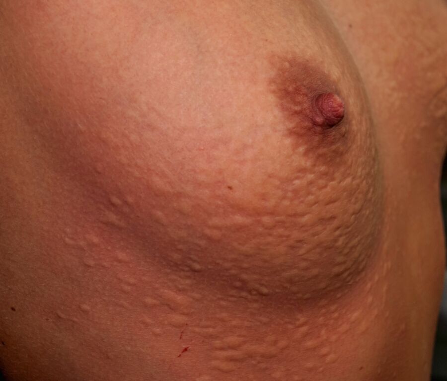 Free porn pics of Tortured pussy and tits | Gemartelde kutjes en tieten 20 of 43 pics